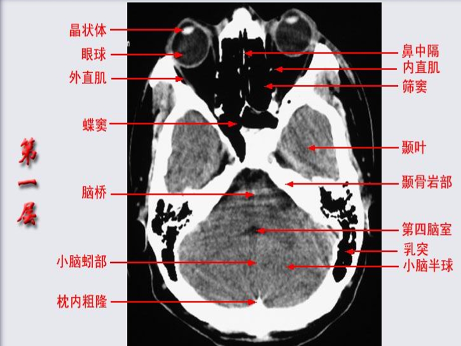 《头颅ct解剖》PPT课件.ppt_第1页