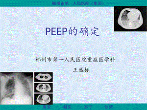 《PEEP的滴定》PPT课件.ppt