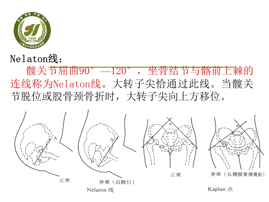 《下肢应用解剖》PPT课件.ppt_第2页