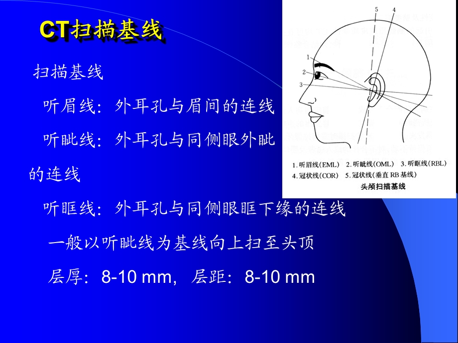 《头颅CT扫描技术》PPT课件.ppt_第3页