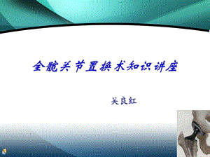 《全髋置换健康讲座》PPT课件.ppt