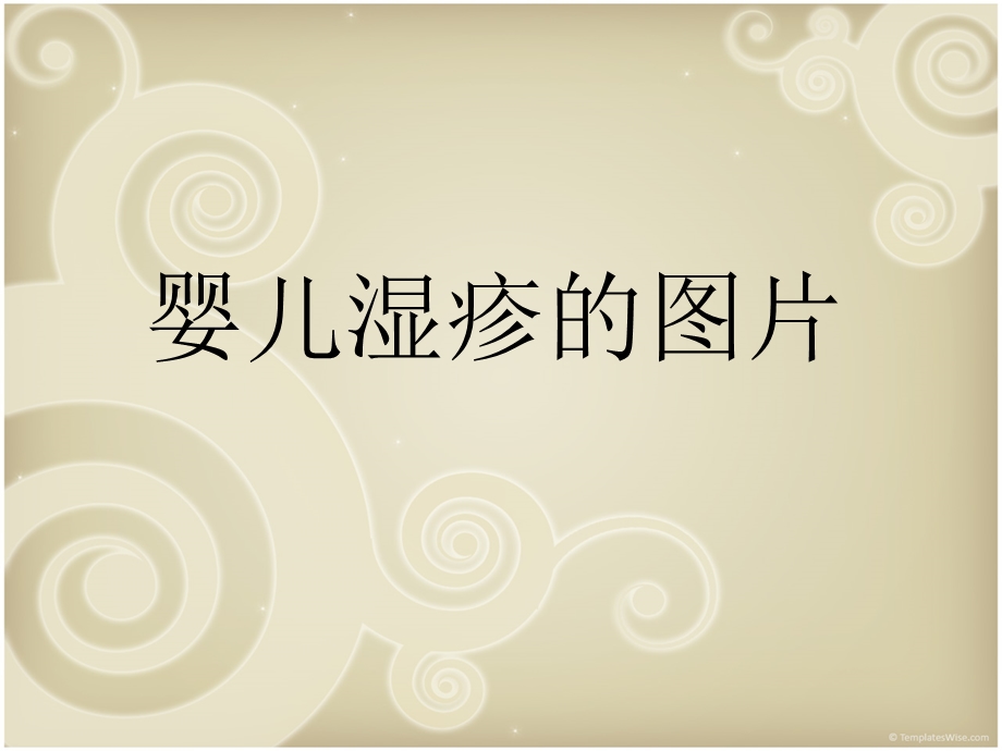 《婴儿湿疹的》PPT课件.ppt_第1页