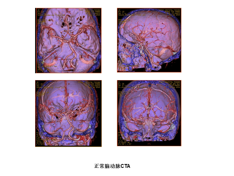 《头颈部血管》PPT课件.ppt_第2页