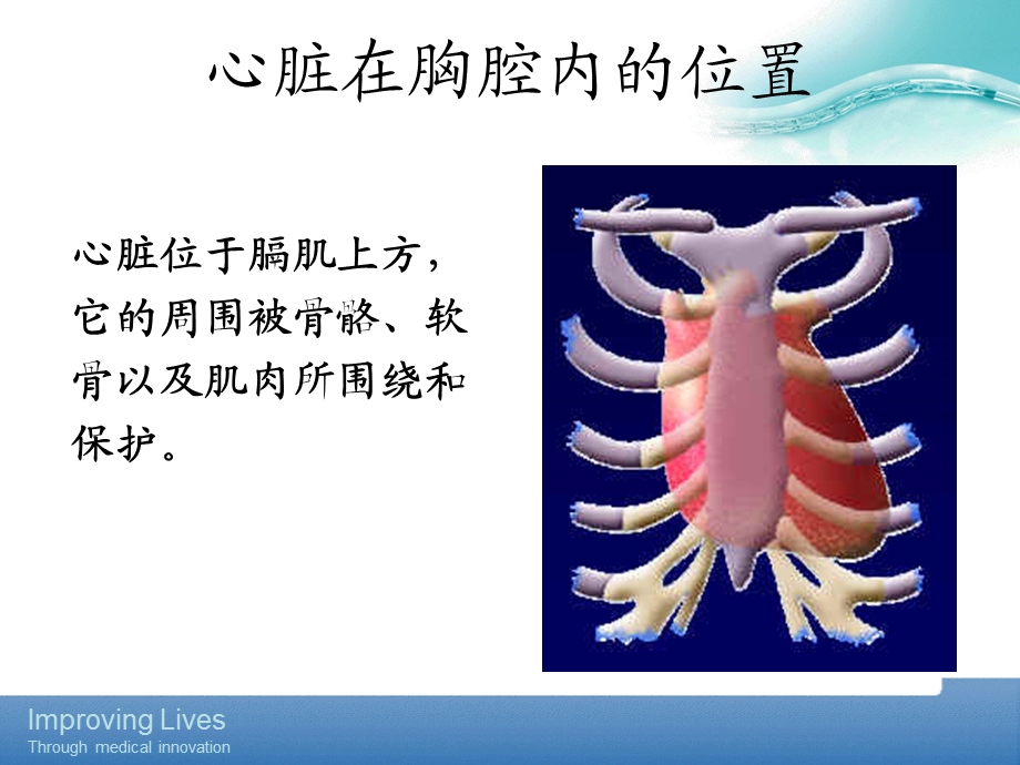 《PTCA基础知识》PPT课件.ppt_第3页