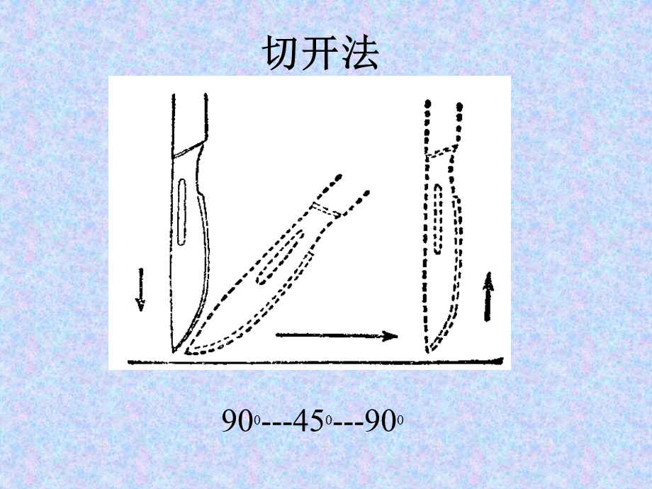 《外科手术基本技术》PPT课件.ppt_第3页