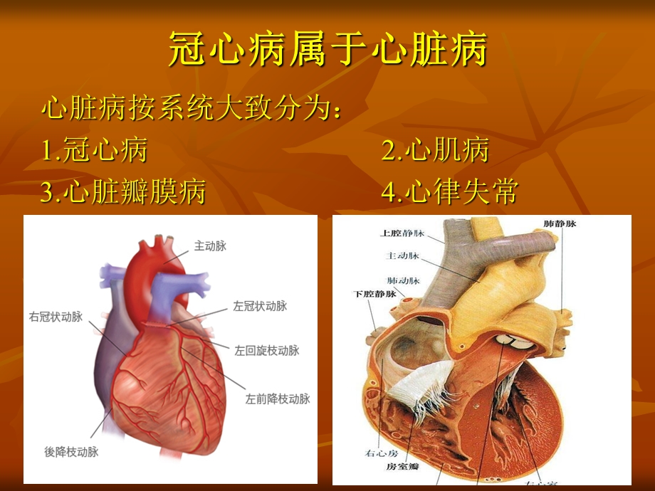 《冠心病与猝死》PPT课件.ppt_第2页