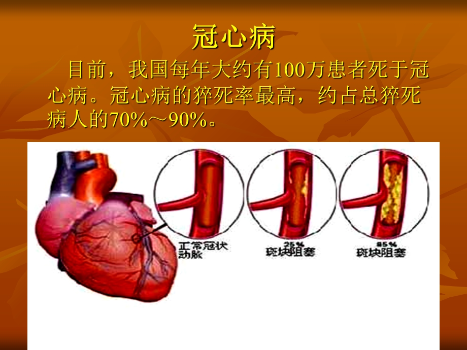 《冠心病与猝死》PPT课件.ppt_第3页