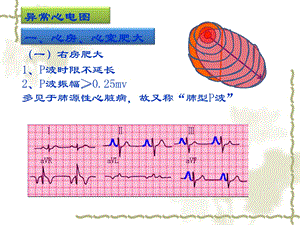 实验诊断学：异常心电图检查.ppt