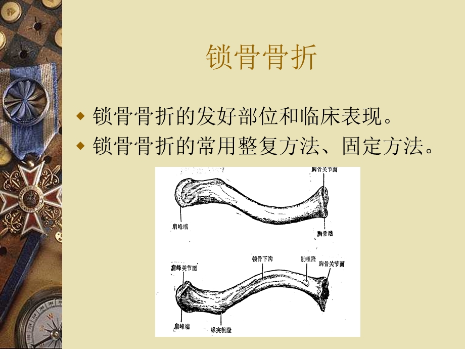 上肢骨折复习.ppt_第2页