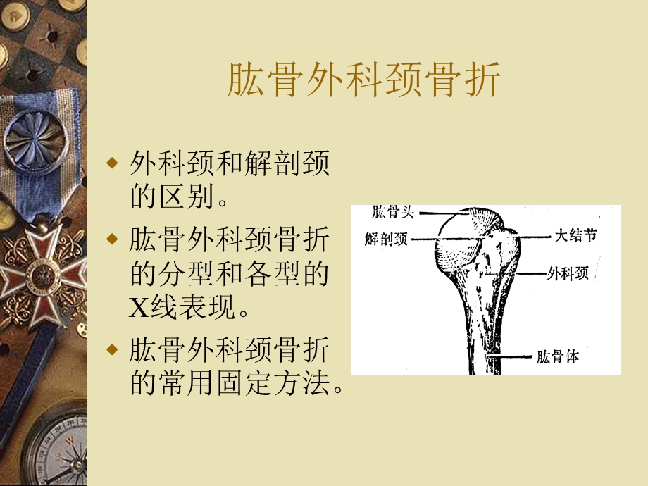 上肢骨折复习.ppt_第3页