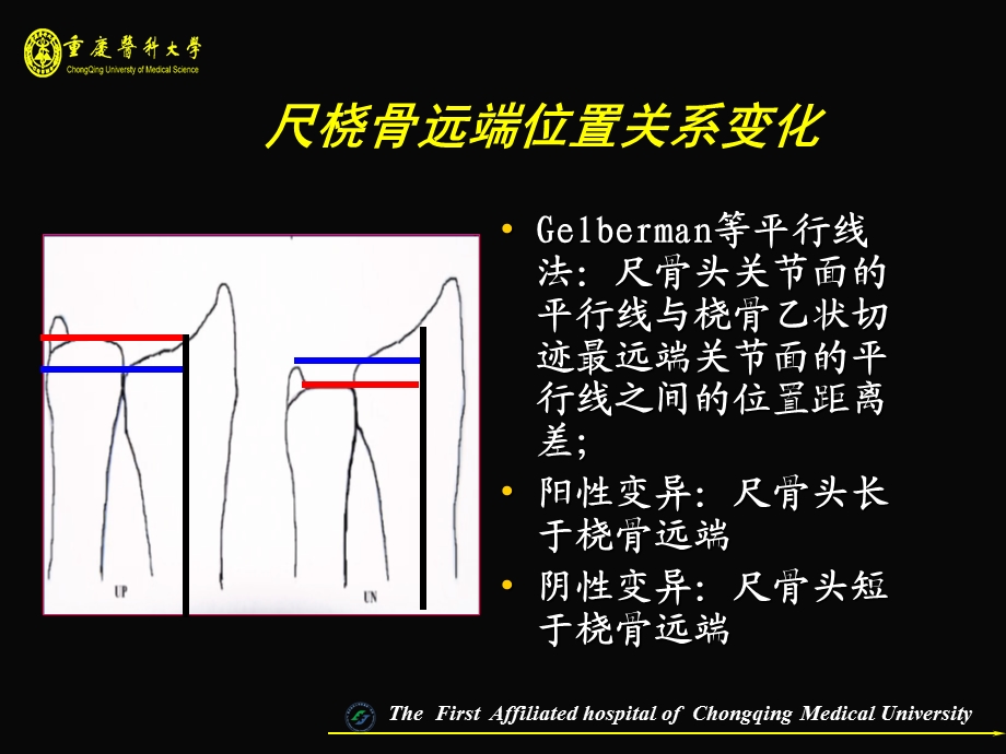 腕关节损伤MRI.ppt_第3页