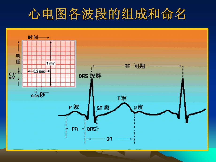 《心电图学小结》PPT课件.ppt_第3页