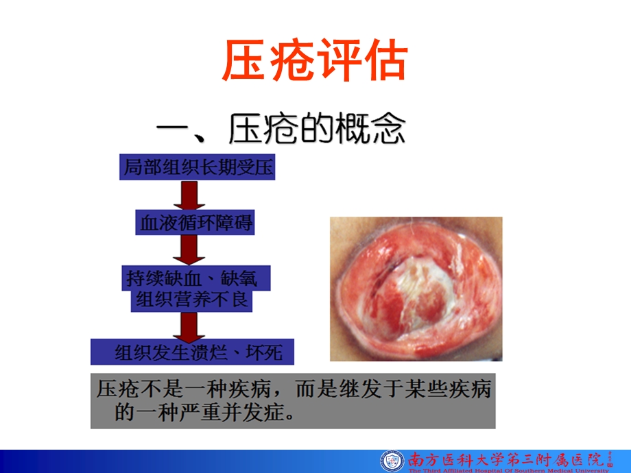 《压疮风险评估》PPT课件.ppt_第3页