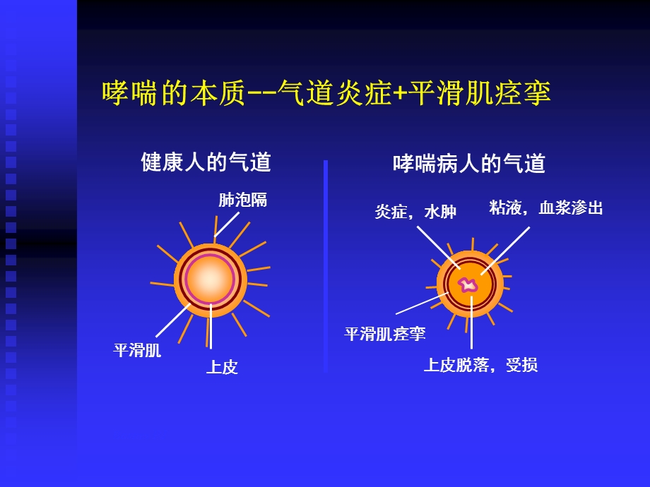 《呼吸药物使用》PPT课件.ppt_第2页