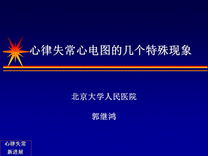 心律失常心电图的几个特殊现象.ppt