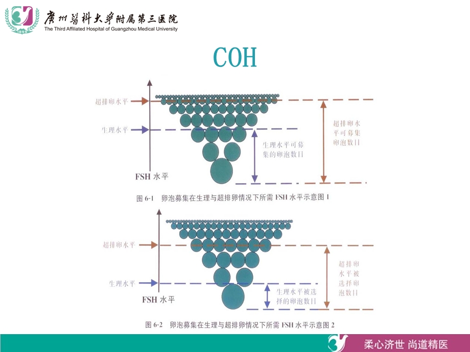 《常见ART方案》PPT课件.ppt_第3页