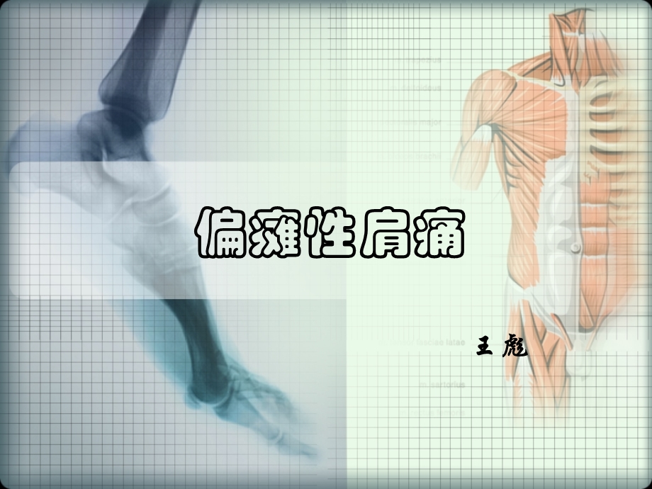 《偏瘫性肩痛》PPT课件.ppt_第1页