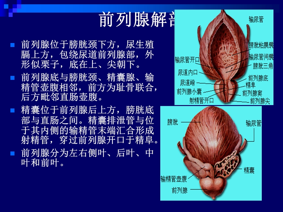 《前列腺超声》PPT课件.ppt_第2页