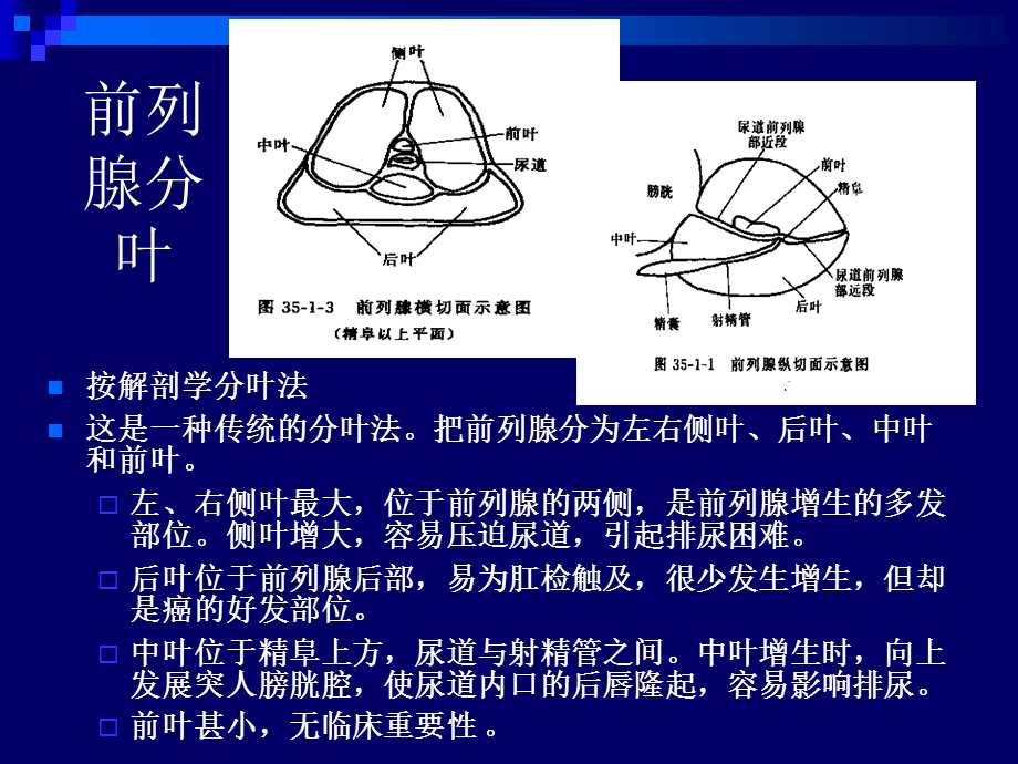 《前列腺超声》PPT课件.ppt_第3页