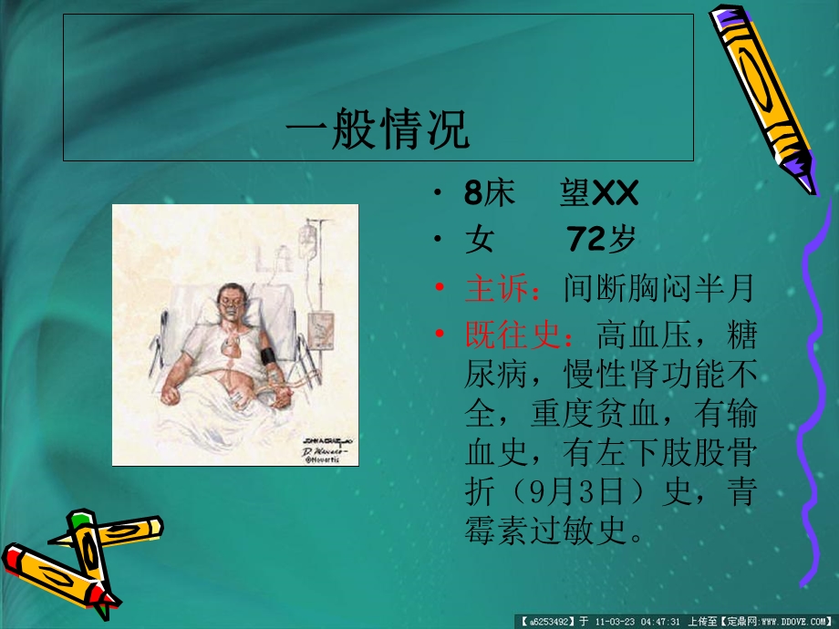 《心绞痛护理查房》PPT课件.ppt_第2页