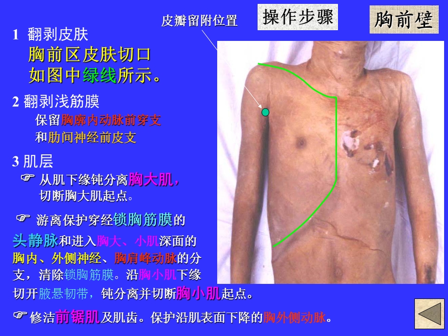 《局解操作上肢》PPT课件.ppt_第2页