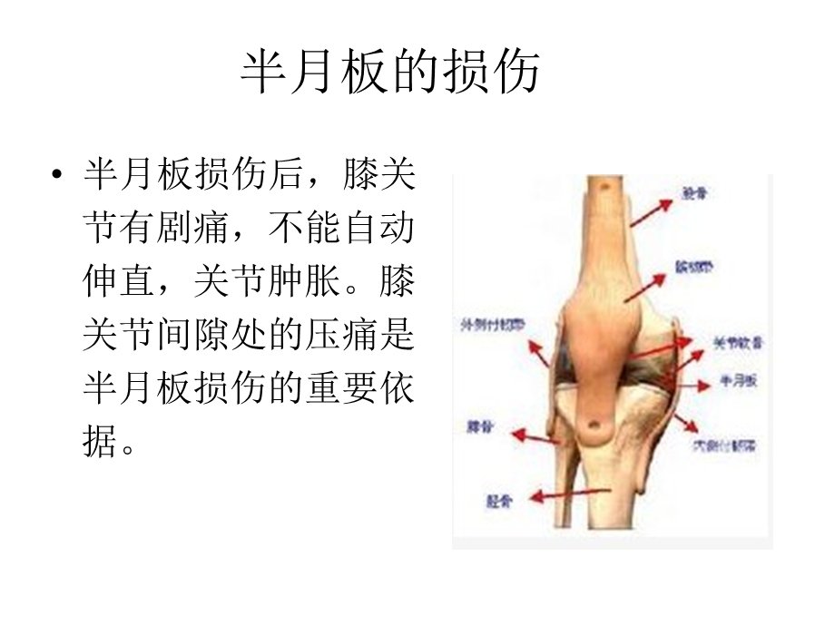 《半月板的损伤》PPT课件.ppt_第2页