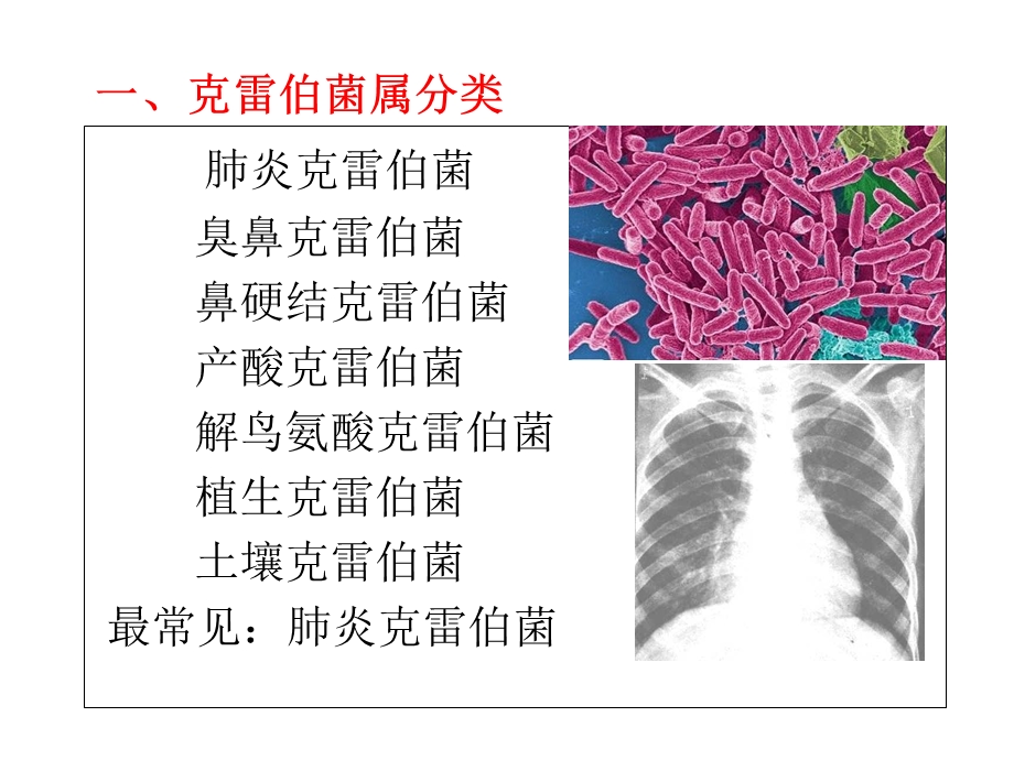 《克雷伯菌属》PPT课件.ppt_第3页