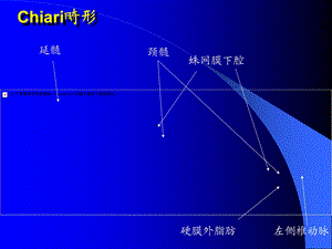 《头部CT诊断》PPT课件.ppt