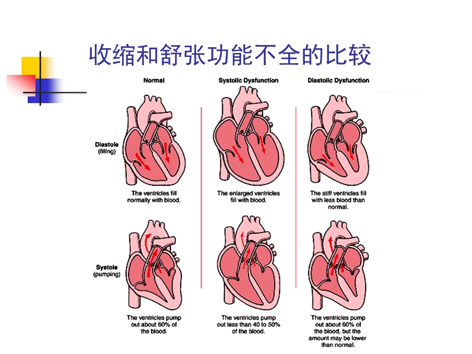 心力衰竭修改版.ppt_第3页