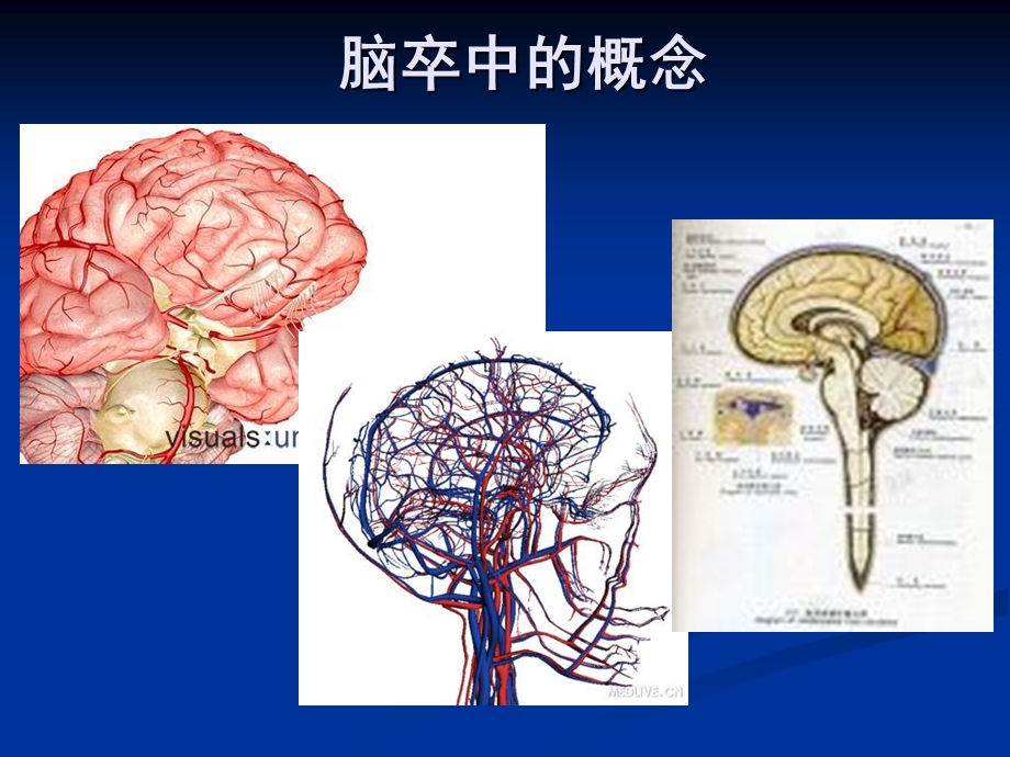 《卒中二级预防》PPT课件.ppt_第3页