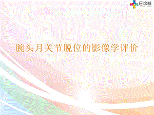 医学影像头月关节脱位的影像表现.ppt