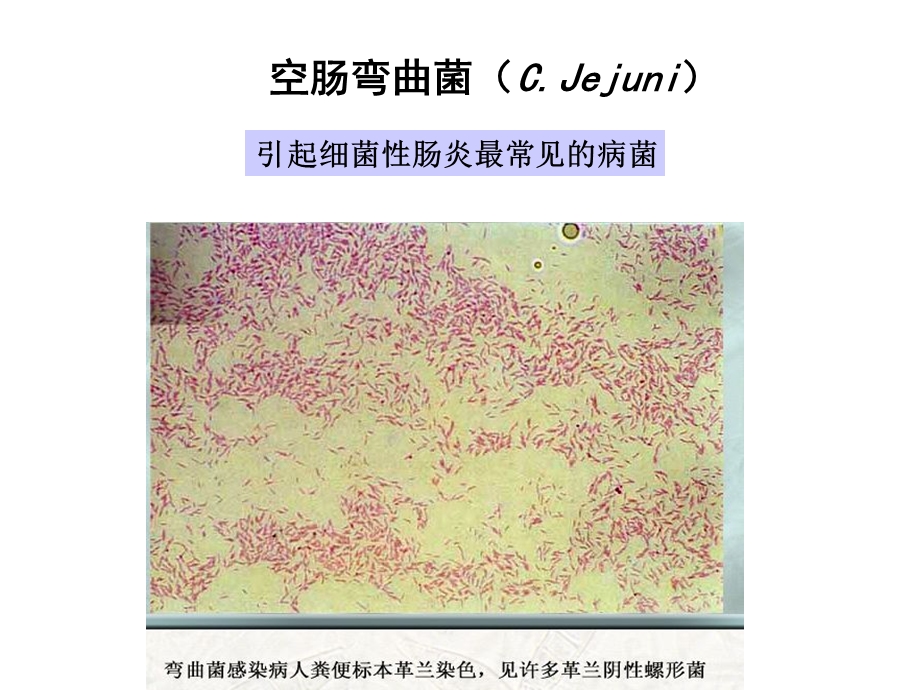 《其他病原细菌》PPT课件.ppt_第2页