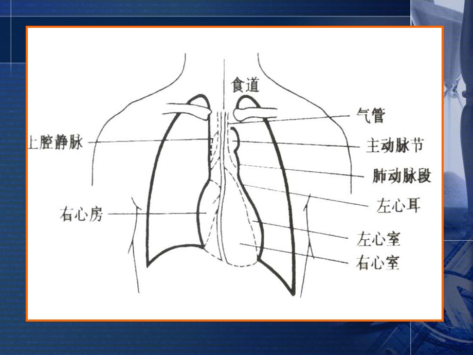 《心脏检体诊断》PPT课件.ppt_第3页