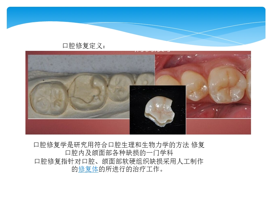 《口腔修复讲课》PPT课件.ppt_第3页