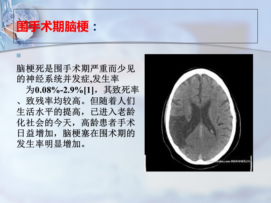 《围手术期脑梗》PPT课件.ppt_第2页