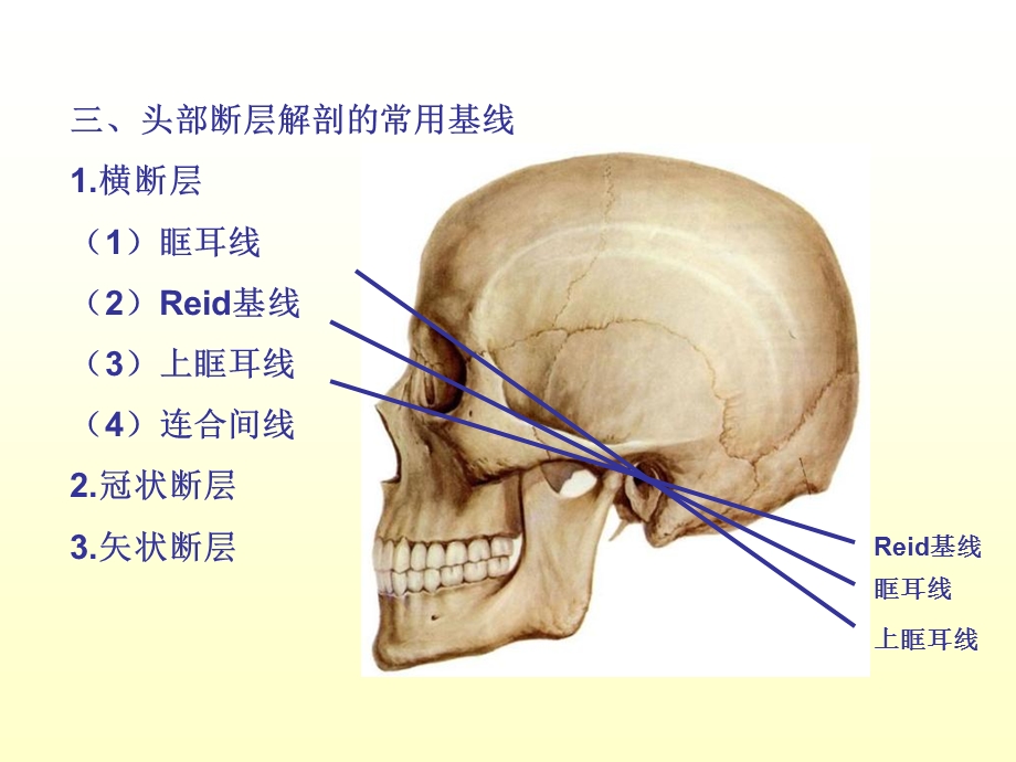 《头部断层》PPT课件.ppt_第3页