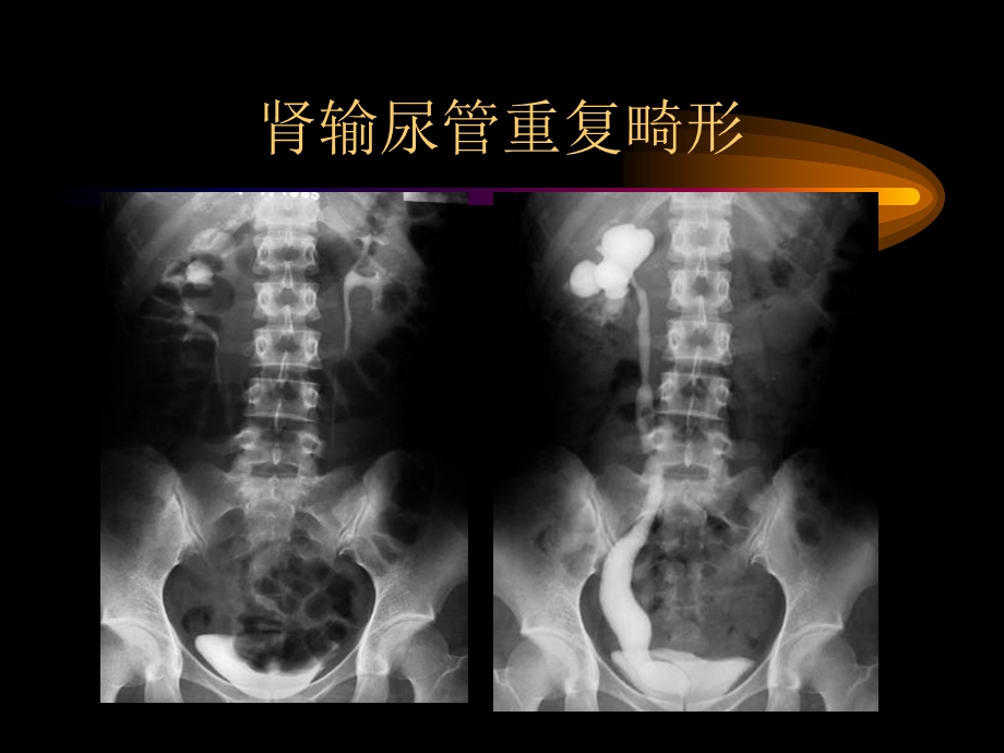 《泌尿生殖图库》PPT课件.ppt_第3页