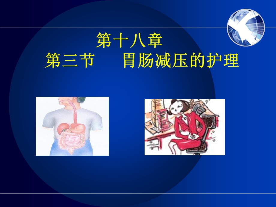 《胃肠减压》PPT课件.ppt_第1页