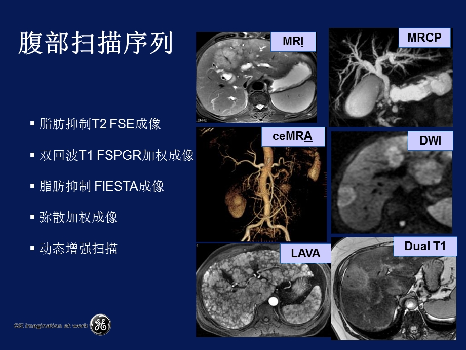 《腹部方法》PPT课件.ppt_第3页