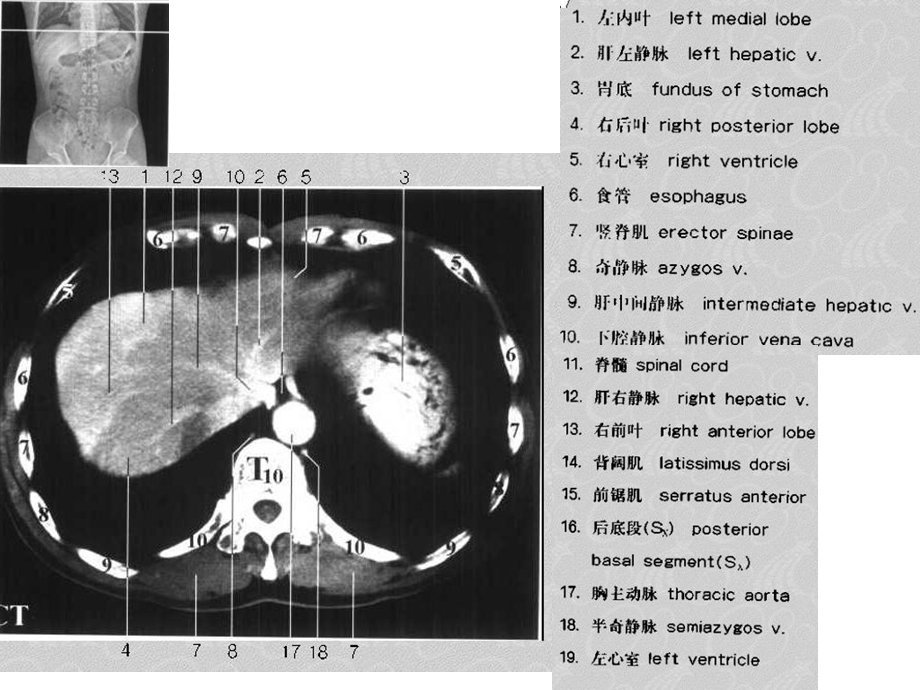 《肝脏病变》PPT课件.ppt_第3页