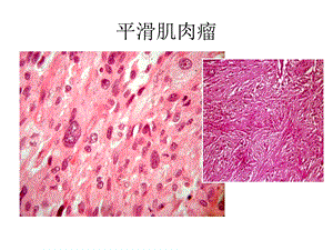 《病理重要切》PPT课件.ppt