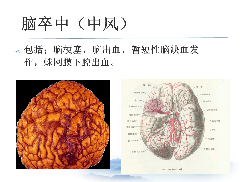 《脑卒中的预防》PPT课件.ppt_第3页