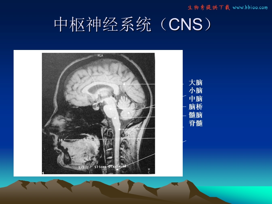 医疗网站(医学百事通)大脑血管解剖经颅超声.ppt_第3页