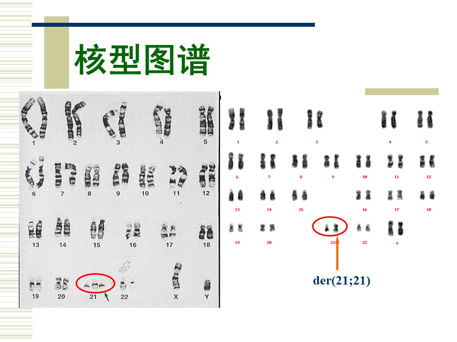 《唐氏产前筛查》PPT课件.ppt_第3页