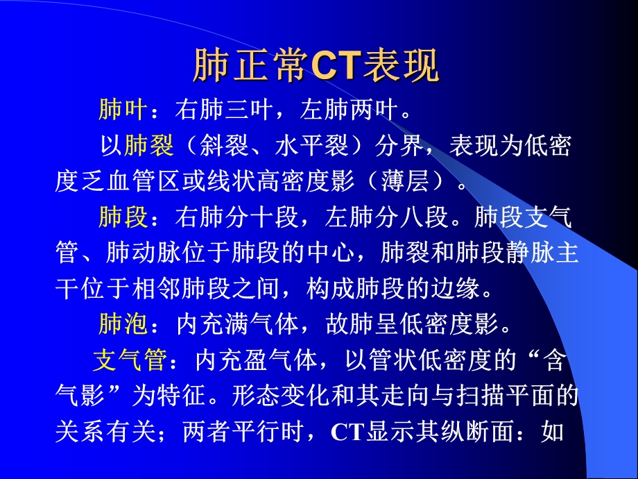 胸部CTppt课件.ppt_第3页