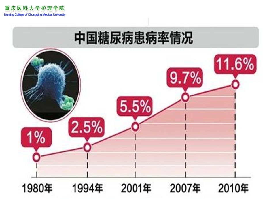 《糖尿病小讲课》PPT课件.ppt_第2页