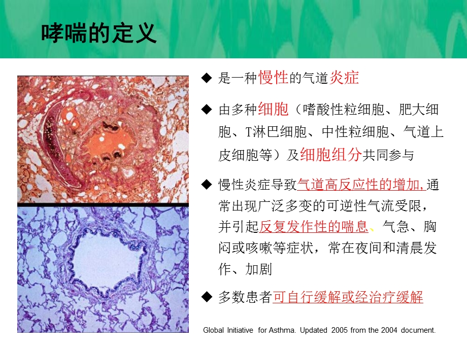 《吸入激素健康调查》PPT课件.ppt_第3页