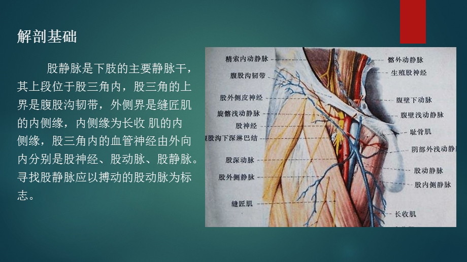 《股静脉穿刺术》PPT课件.ppt_第3页