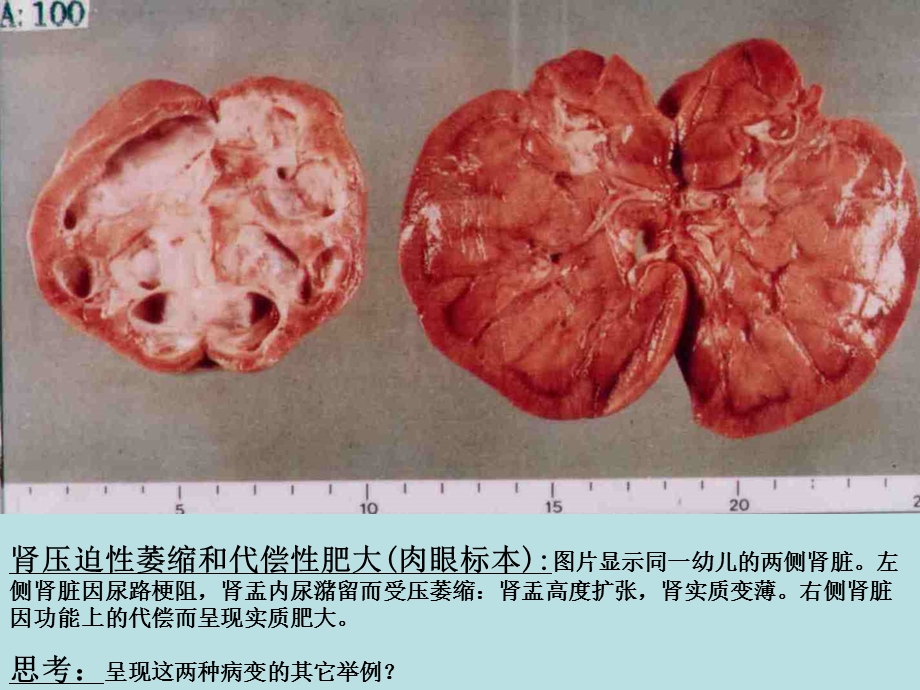 《病理实验图片》PPT课件.ppt_第2页