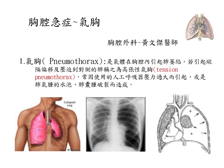 胸腔急症气胸.ppt_第1页